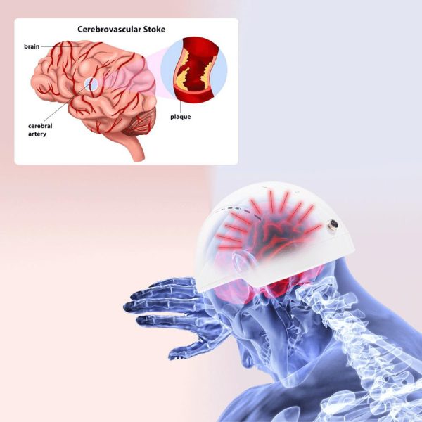 Brain Photbiomodulation Helmet - Image 2