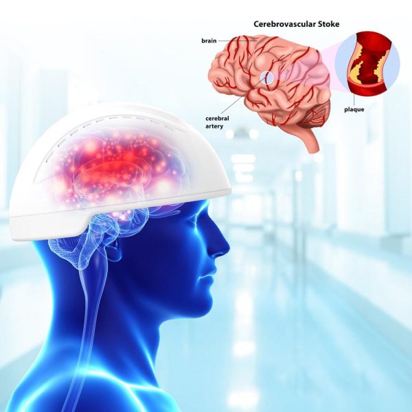 Brain Photbiomodulation Helmet - Image 8